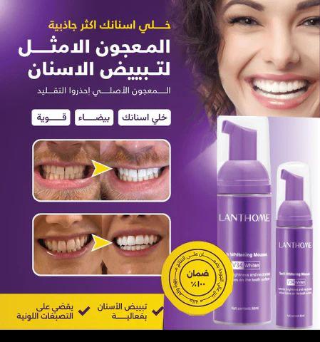 V34 TEETH WHITENING