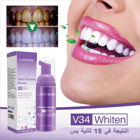 V34 TEETH WHITENING